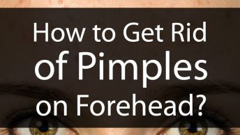 How to Get Rid of Pimples on Forehead