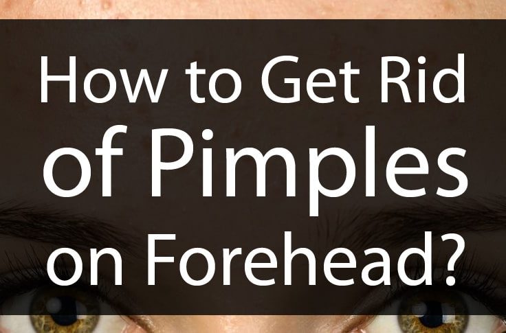 How to Get Rid of Pimples on Forehead