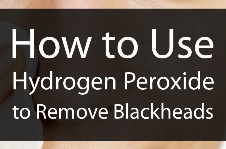 How to Use Hydrogen Peroxide to Remove Blackheads