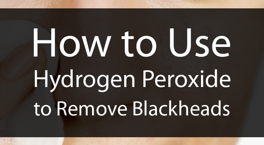 How to Use Hydrogen Peroxide to Remove Blackheads