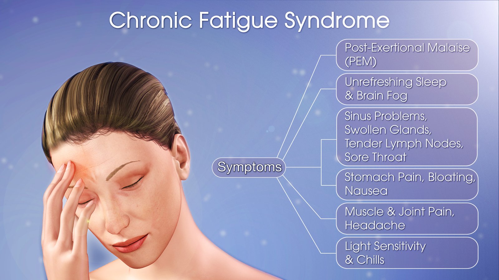 Showing-Symptoms-Of-Chronic-Fatigue-Syndrome.jpg